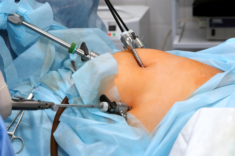 Patient discussing whether she needs keyhole surgery with a laparoscopic surgeon in North Delhi