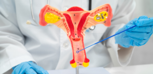 What happens if I skip Pap smear?